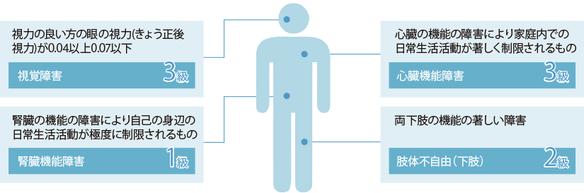 身体障害認定基準の例
